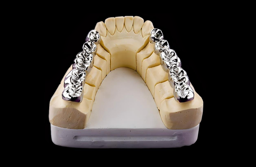 High-Noble Full Gold Crowns